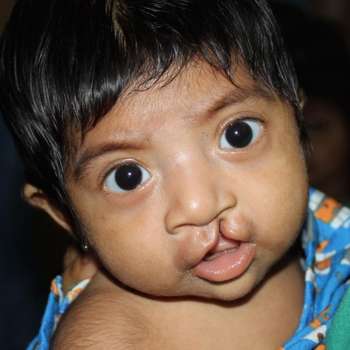 child who needs surgery