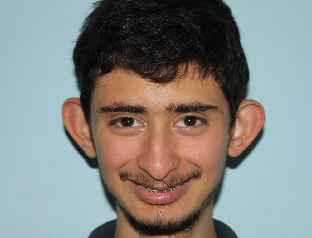 Brandon pre-surgery