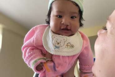 happy baby being held by parent pre-surgery