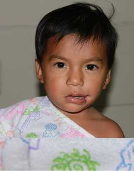child before surgery