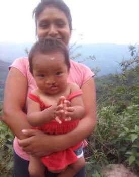 Fabiana before surgery