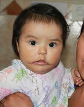 Kihara before surgery